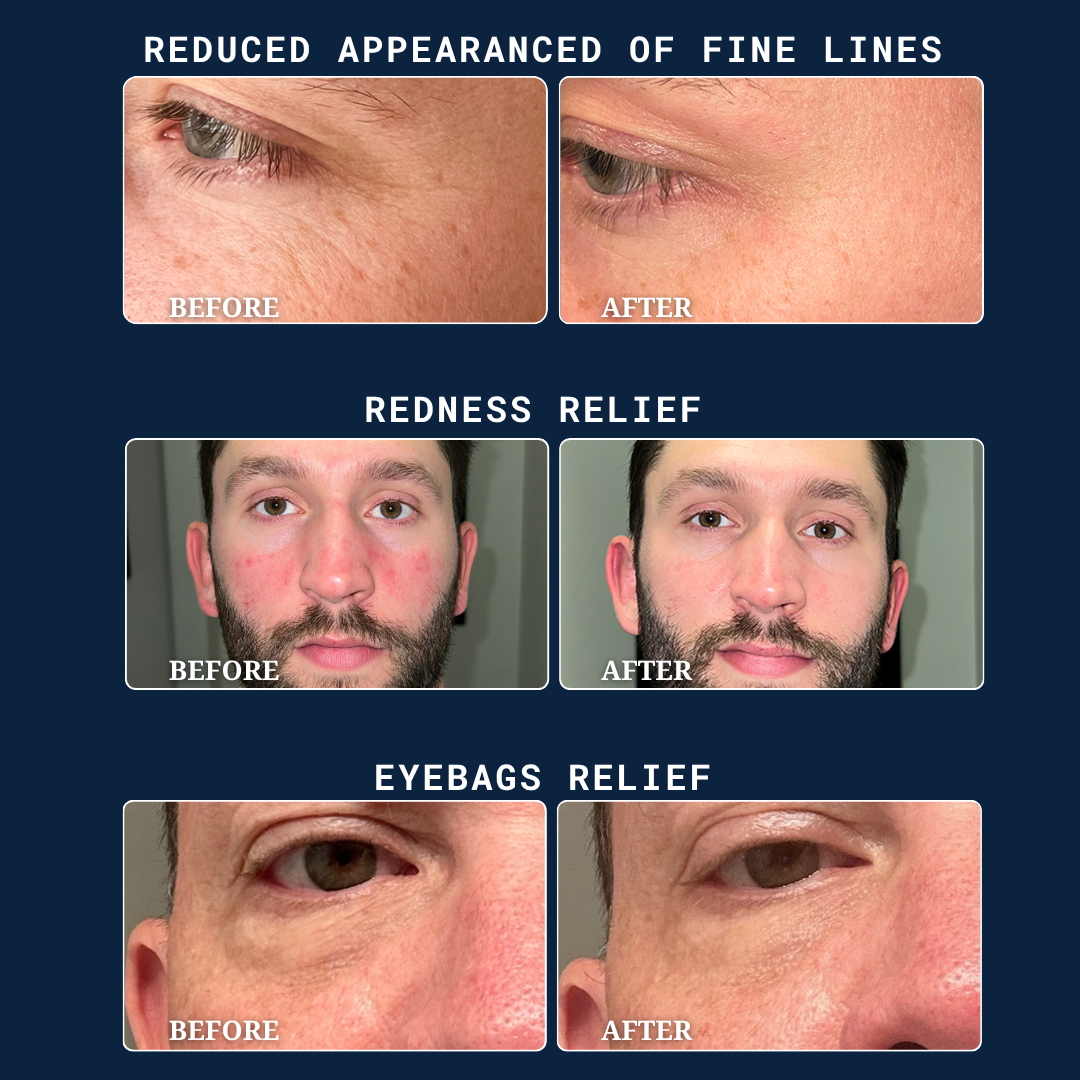 PrettyBoy - Revival Recovery Gel Moisturizer